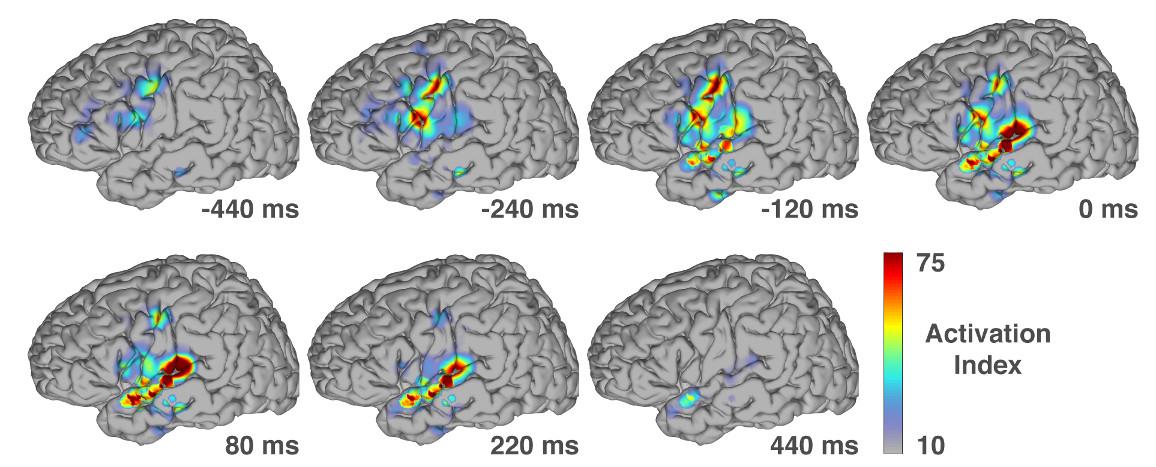 Brain activity at different speech productions. Refer to paragraph below for details.